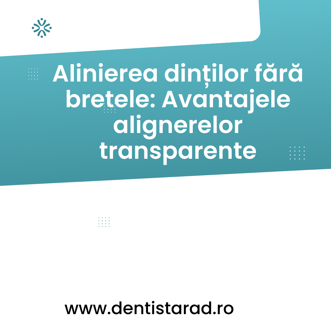 alinierea-dintilor-fara-bretele-avantajele-alignerelor-transparente